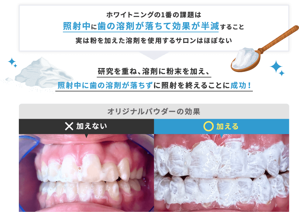 照射中に歯の溶剤が落ちずに照射を終えることに成功！